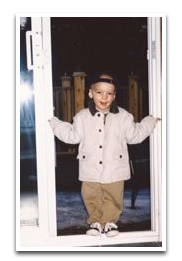 Alopecia 1999